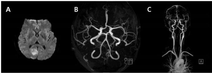 뇌 MRI 및 MRA