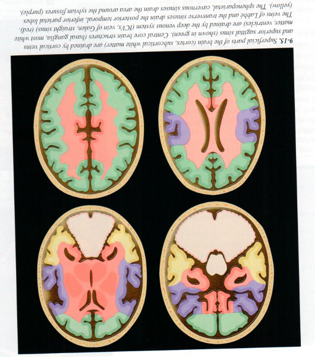 Venous Infarction Pattern