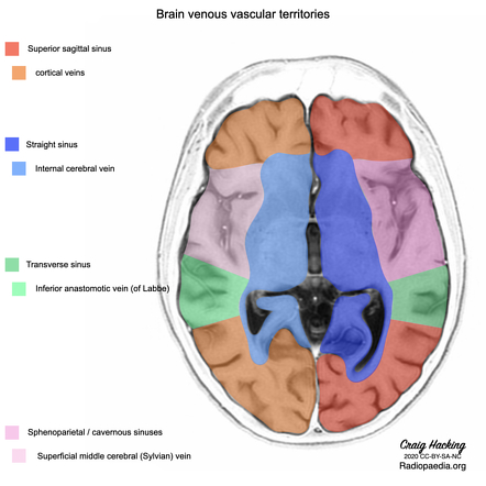 Internal Cerebral Vein Anatomy