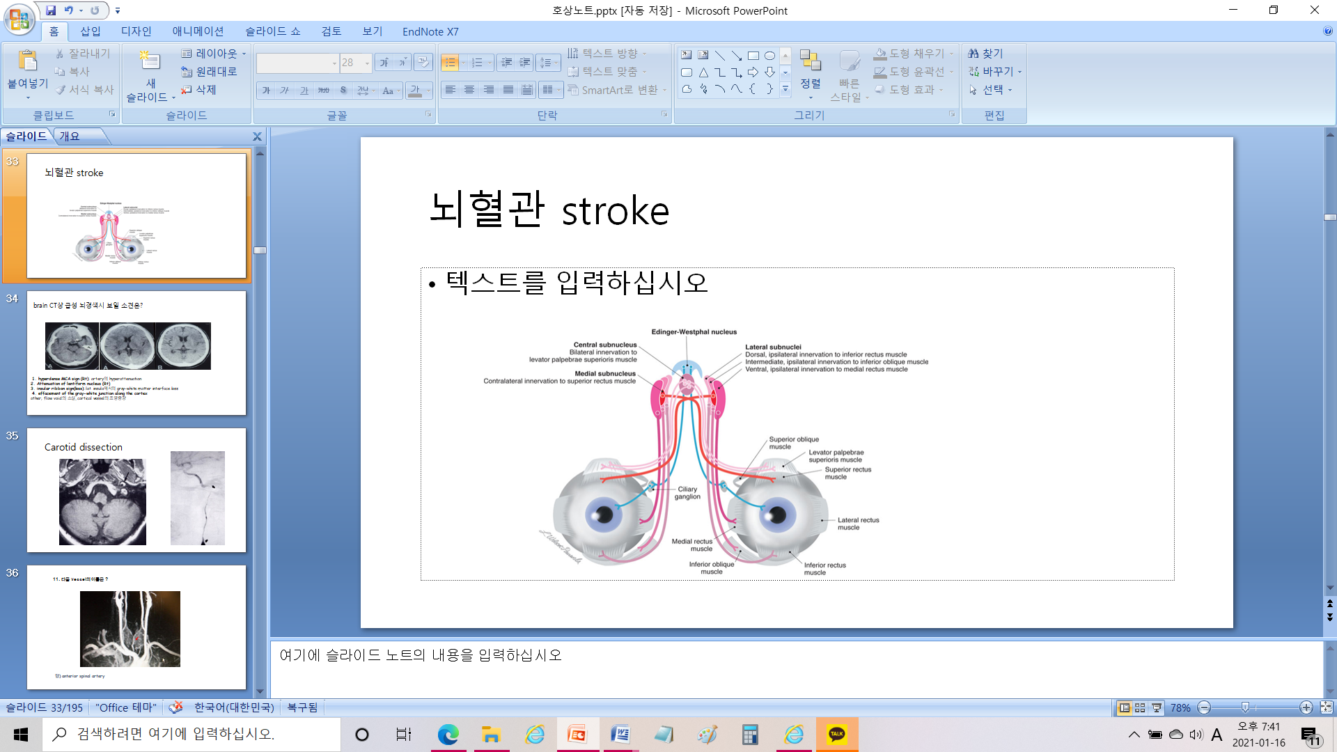 눈돌림신경핵 병변 시 나타나는 안구 운동 장애 양상