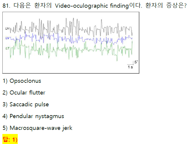 Ocular Flutter VOG Example