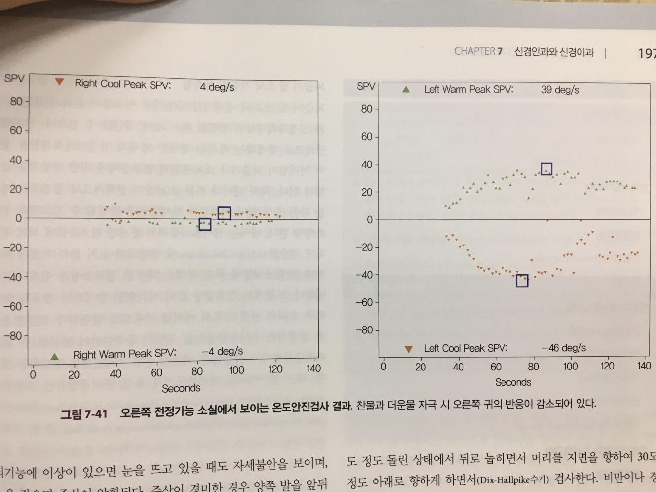 안구 운동의 신경적분체 모식도: 수평 안구 운동 유지에 관여하는 MVN, NPH 및 소뇌의 연결망을 설명하는 도식.