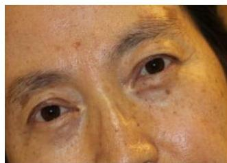우측 머리 기울임
