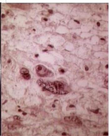 Histopathology H&E stain