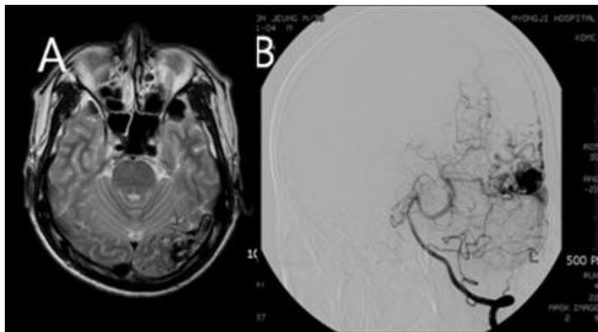 MRI 및 TFCA 영상