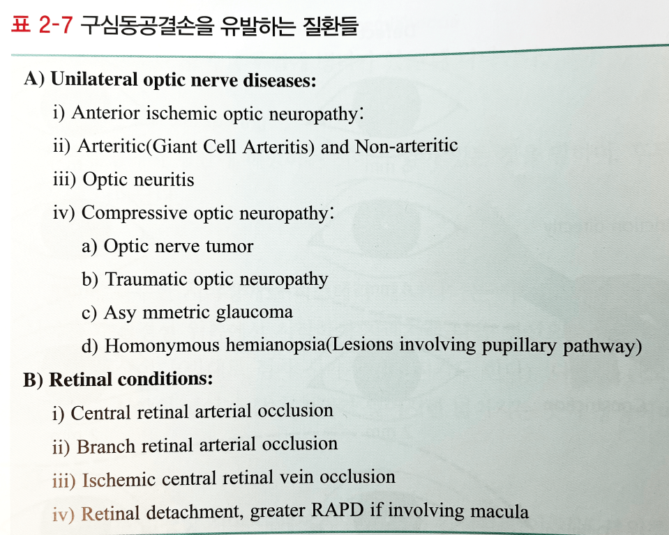 정상 동공 반사와 RAPD 비교 도해