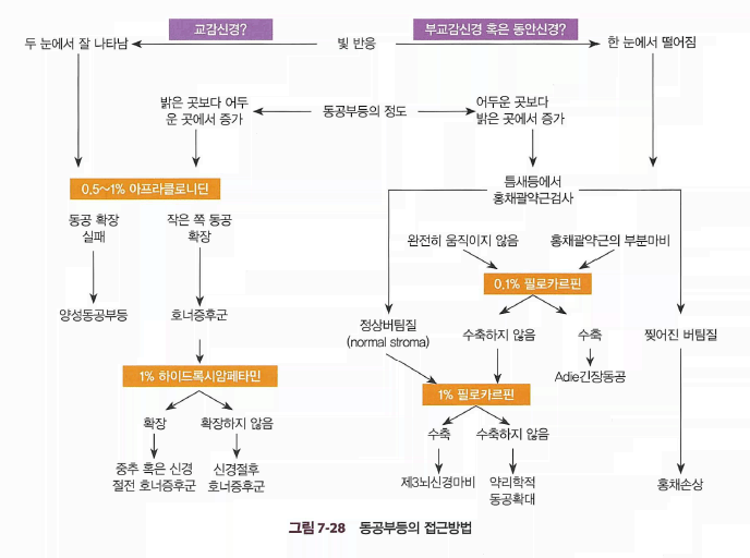 호너 증후군 검사법
