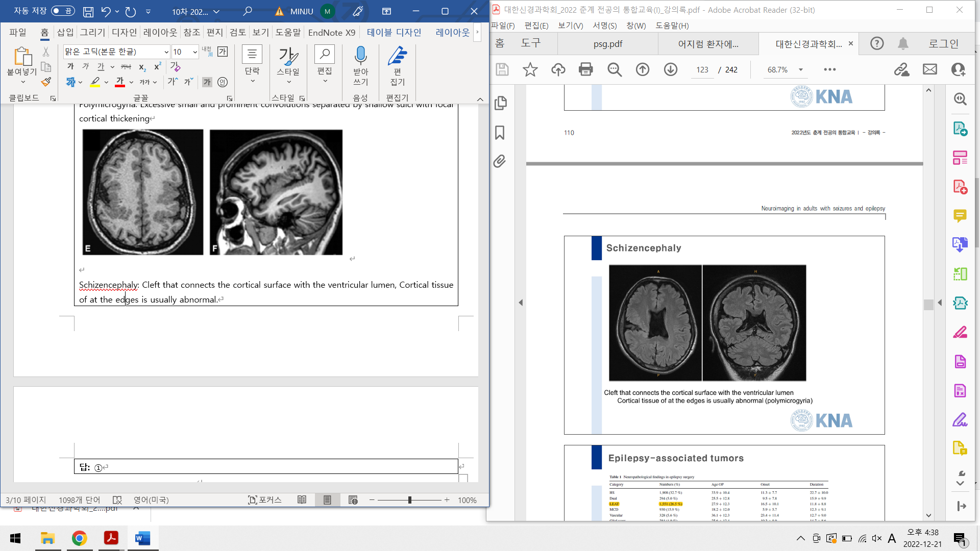 Schizencephaly