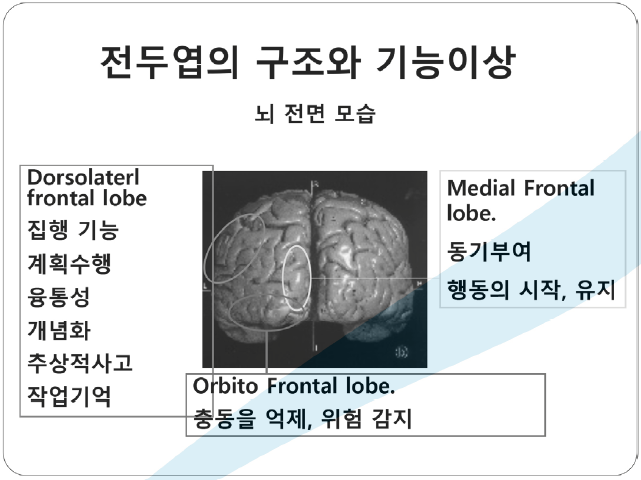 뇌의 내측 및 외측 시스템의 균형을 설명하는 도식. Medial system(SMA 등)이 Lateral system(PMC 등)의 외부 자극 기반 움직임을 억제하는 구조를 보여줌.