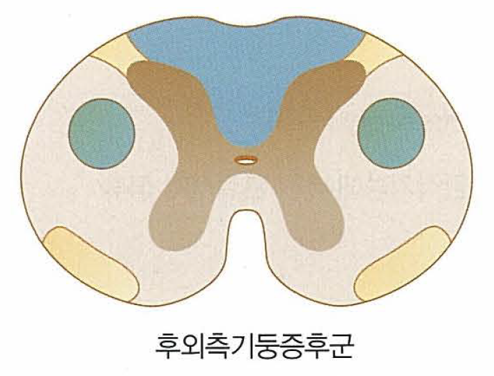 SCD의 주요 침범 부위 및 임상 양상 요약표