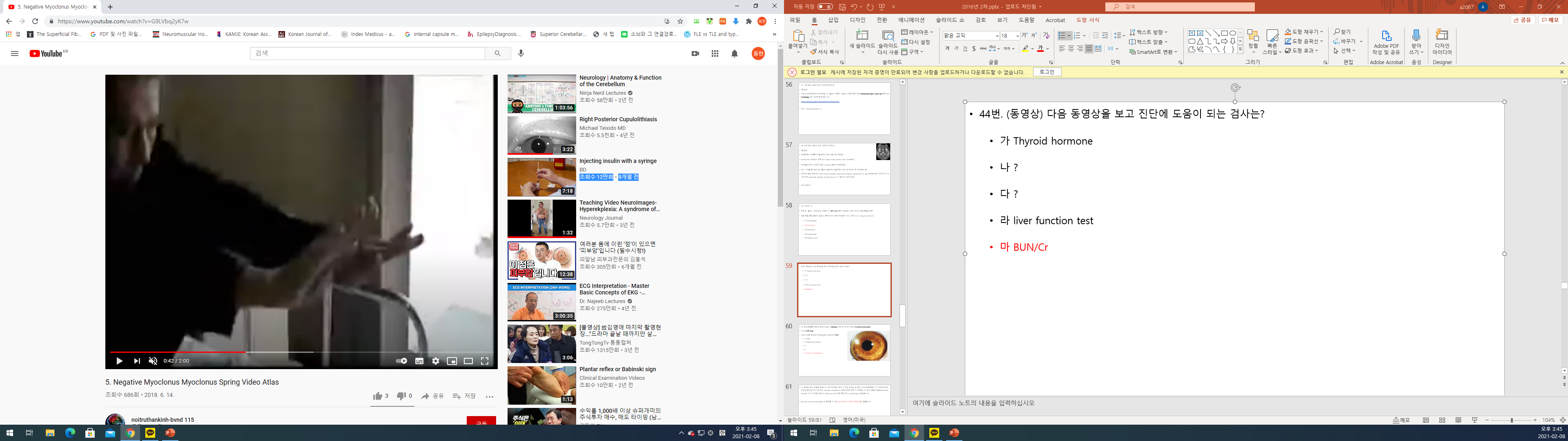 환자가 양팔을 앞으로 뻗고 손등을 몸 쪽으로 젖힌 자세에서 손목이 간헐적으로 아래로 처지는 모습을 보여주는 동영상 캡처