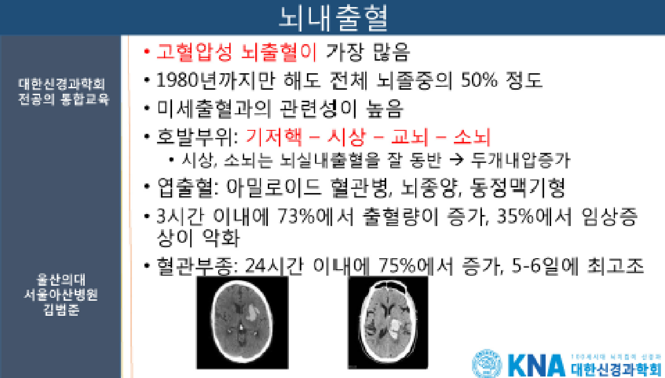 Congo red 염색의 편광현미경 소견: 아밀로이드 침착 부위에서 특징적인 사과색 복굴절이 나타남.