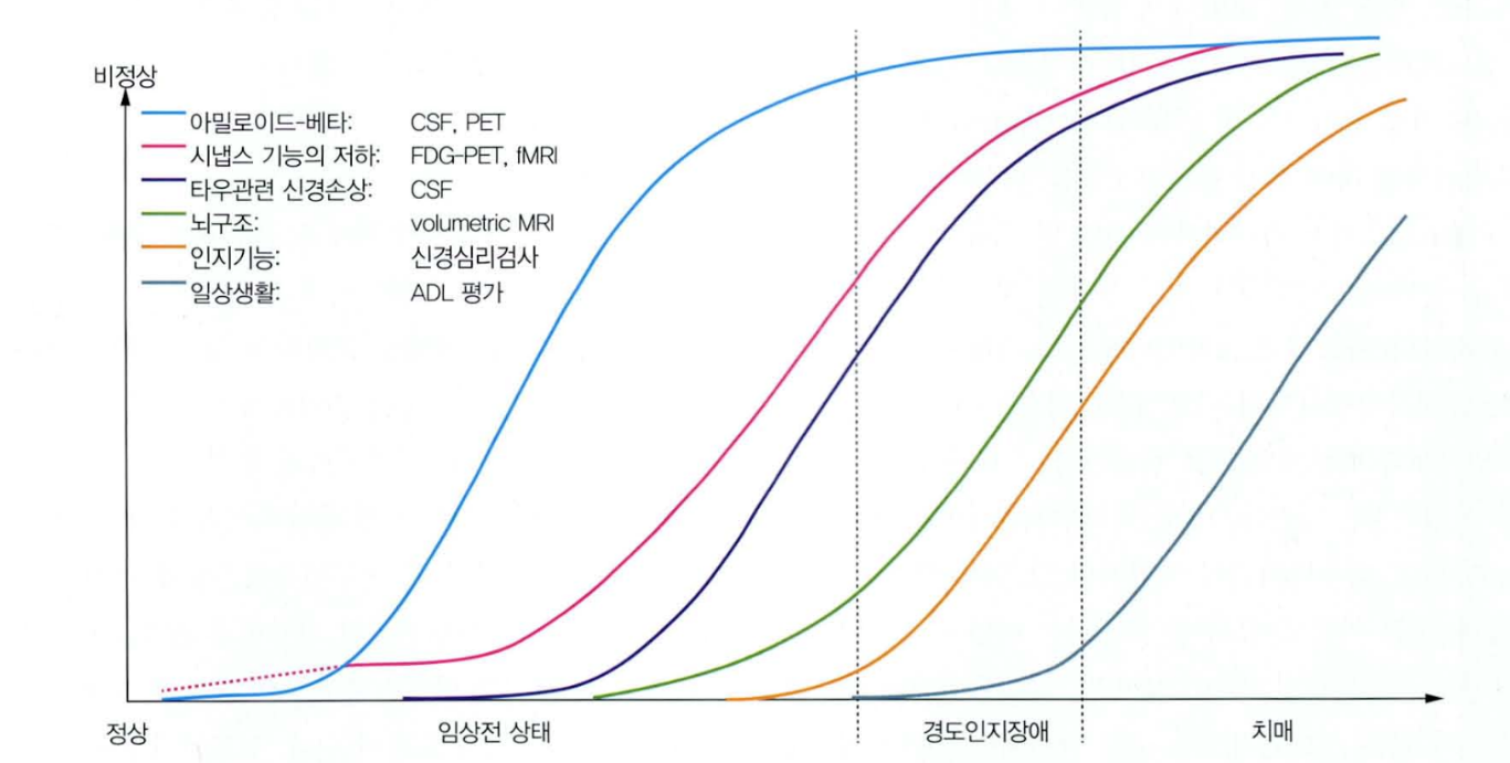 알츠하이머병 가설 모델 상세 그래프