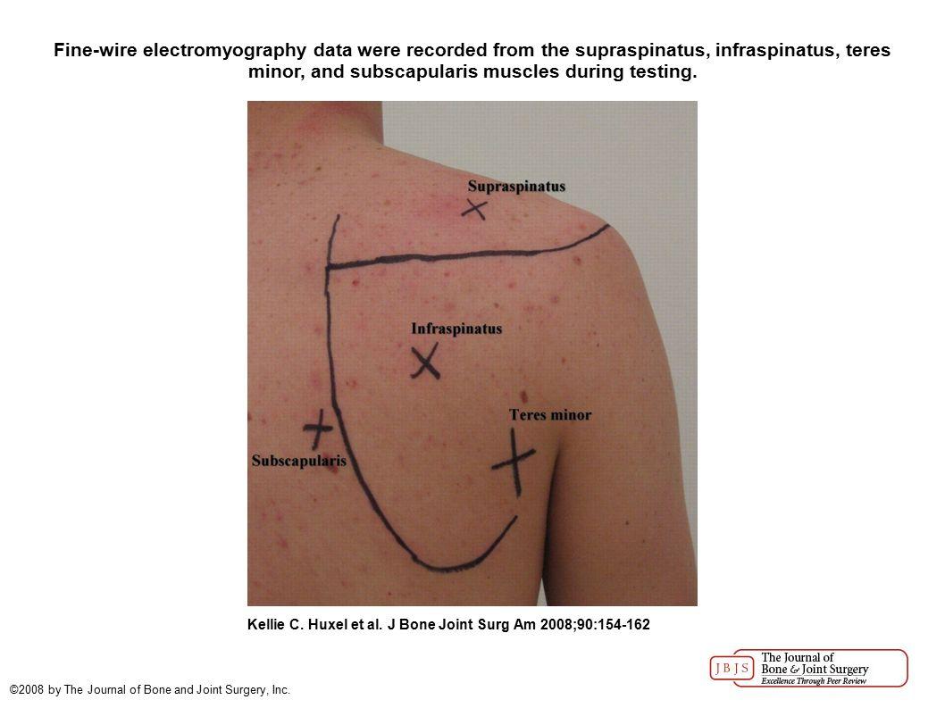 해설 그림: 어깨 주변 근육의 해부학적 위치와 가쪽돌림 기전 설명도