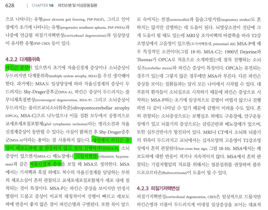MSA-P 환자의 전형적인 MRI 소견. 조가비핵의 위축과 함께 외측의 고신호강도 슬릿을 보여줌.