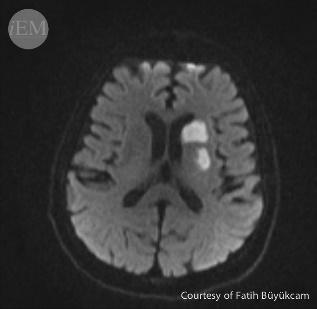 MRI 2