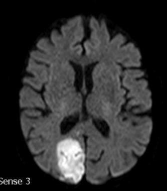 MRI 3