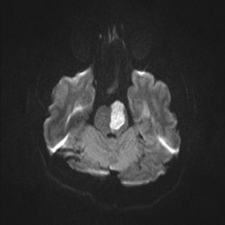 MRI 4