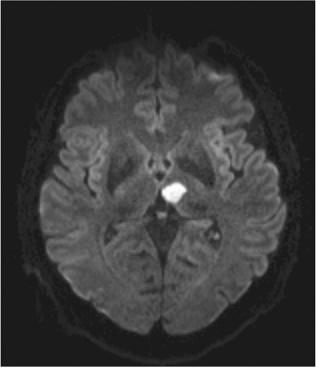 MRI 5