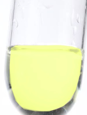 황색변색(Xanthochromic)을 보이는 뇌척수액(CSF)이 담긴 시험관 사진. 투명한 노란색을 띠고 있음.