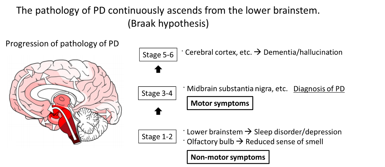 Progression of pathology