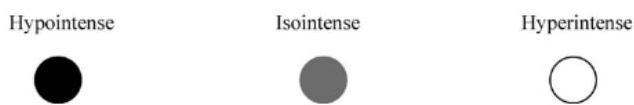 MRI 신호 강도 범례: 검은색 원(Hypointense), 회색 원(Isointense), 흰색 원(Hyperintentse)