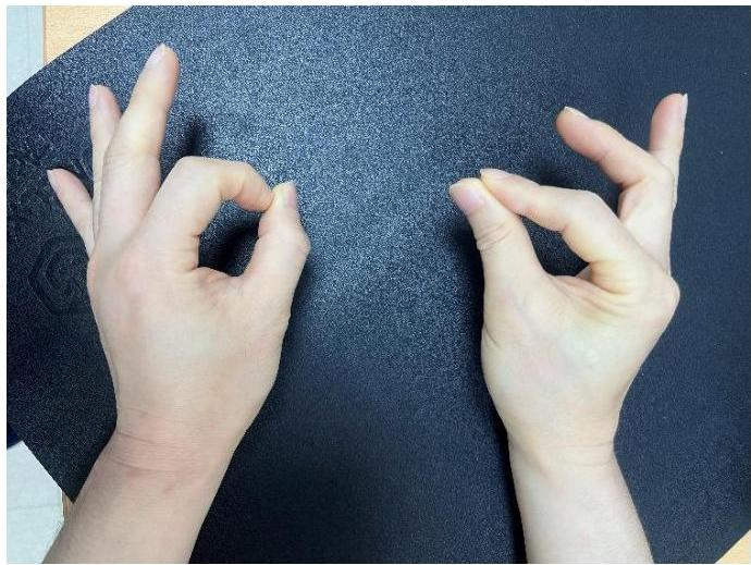 양손으로 OK 사인을 시도하는 사진. 좌측 손은 엄지와 검지가 둥근 원을 그리며 정상적인 OK 사인을 만들고 있으나, 우측 손은 엄지의 IP 관절과 검지의 DIP 관절이 굽혀지지 않아 손가락 끝면을 서로 평평하게 맞대고 있는 'Pinch sign' 양상을 보임.