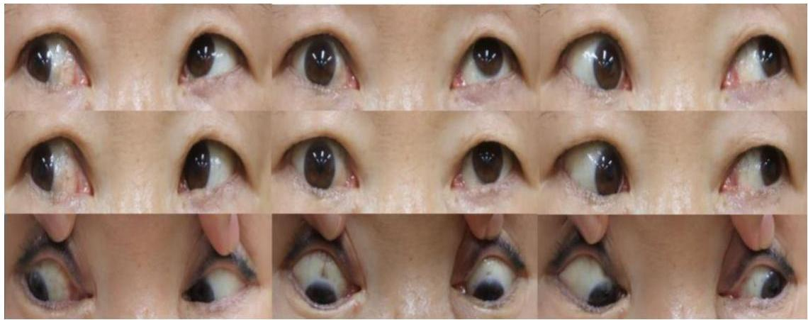 9-gaze photo
