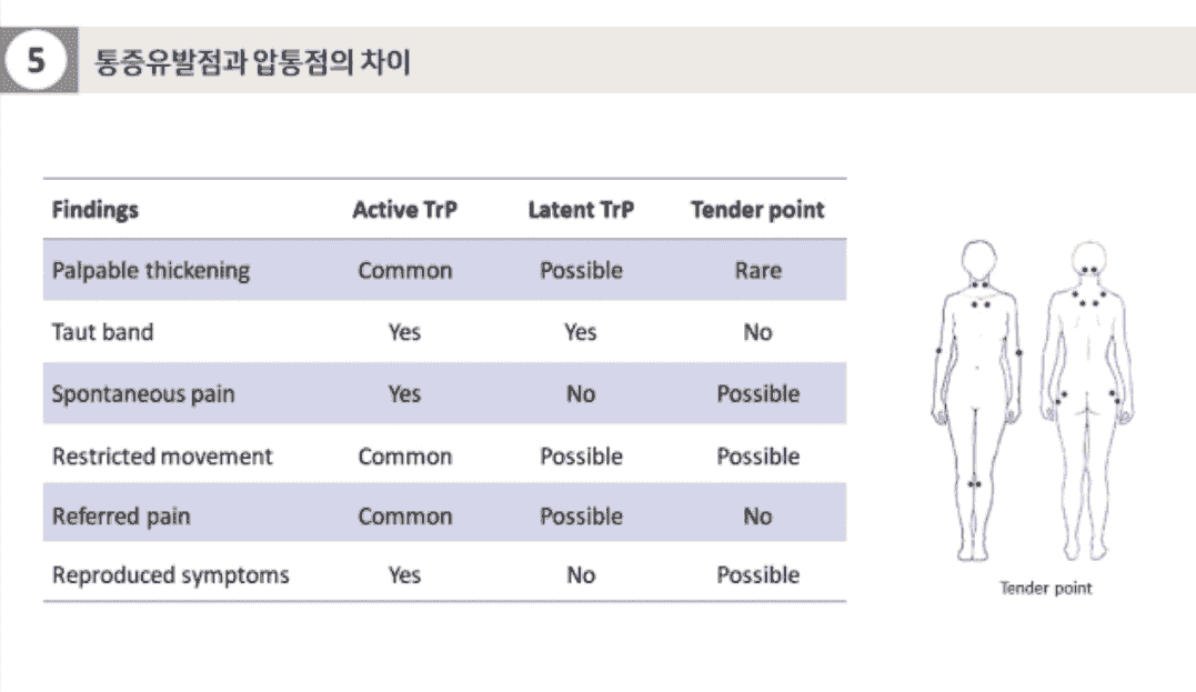 근막유발점의 분류 및 특징 비교표