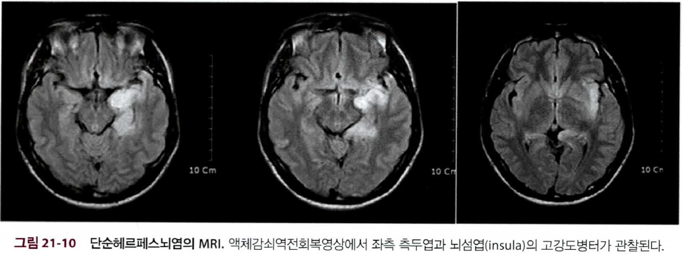 MRI Comparison