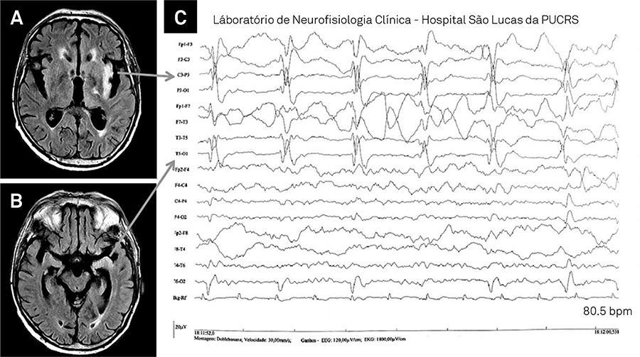 EEG Detail