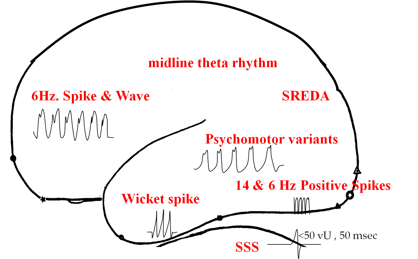 Normal variants 요약표