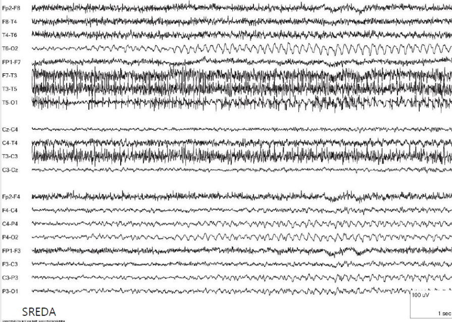 SREDA 예시