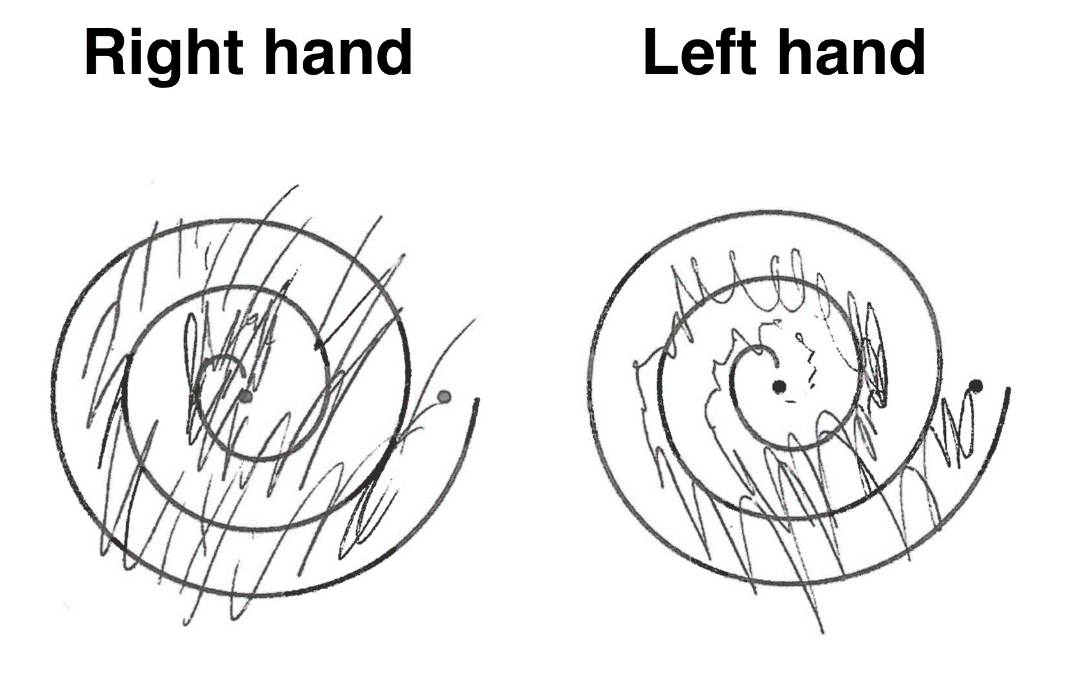 Archimedes spiral