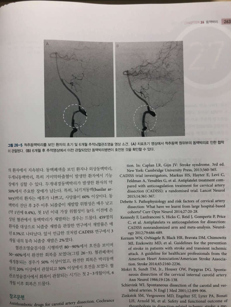 다양한 동맥박리의 혈관조영술 증례