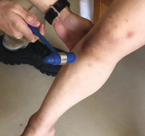 Knee DTR examination