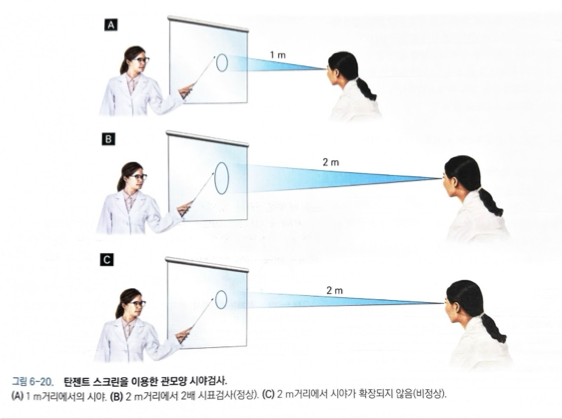 정상과 관모양 시야 비교