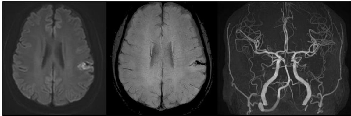 Brain MRI and MRA