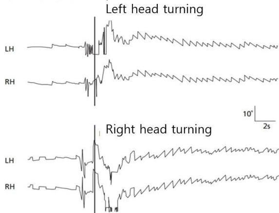Supine head roll test VNG