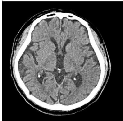 NCCT_3