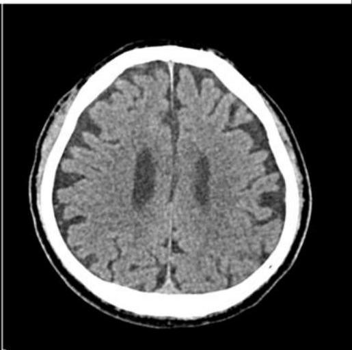 NCCT_4